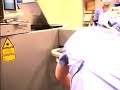 レーシック