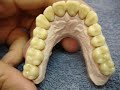 ceramica dental