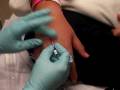 E.R trip  (is you don't like needles, don't watch)
