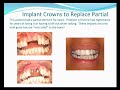 Dental Implants| and Dentures- Glen Ellyn (near Chicago)