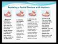 Dental-Implants-and-