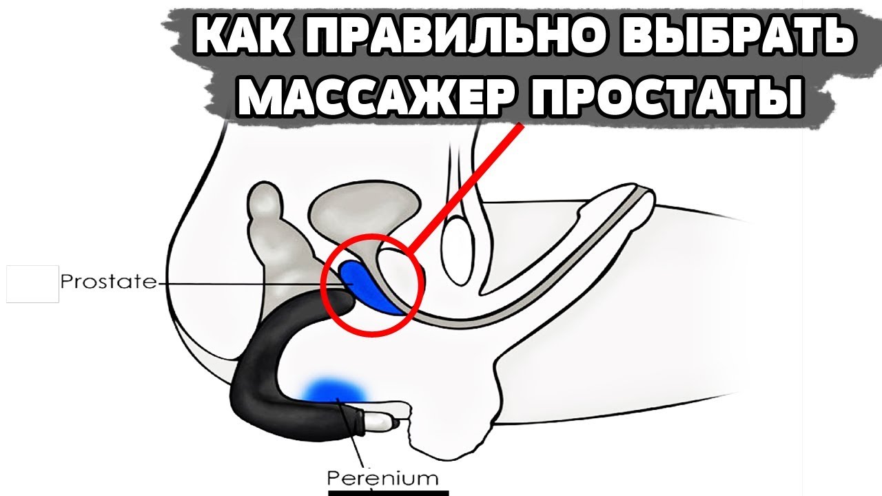 Как Выбрать Массажер Простаты.m.Uvipe.com