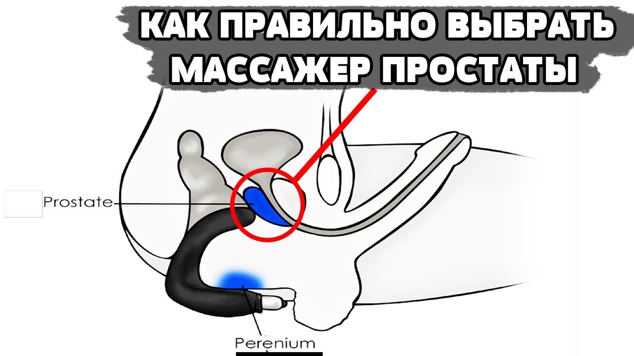 Сделать Массаж Простаты Самому Порно