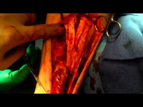 how to repair dpm 2012