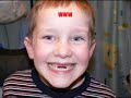 ADHD Help Video #7 ADHD NATURAL