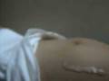 videos de EMBARAZO 32 SEMANAS SEGÚN ÚLTIMA MENSTRUACIÓN - Pregnancy 32 Week-rinitis allergic.