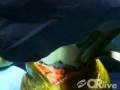 videos de Total Knee Replacement Surgery