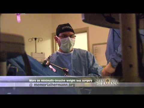Gastric Sleeve - Memorial Hermann Hospital The Woodlands