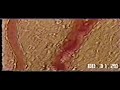 Microcirculation Observation Test Danshen