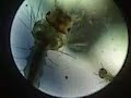 More Mosquito Larvae, Blackberry video through Microscope! More Mosquito Larvae, Blackberry video through Microscope!