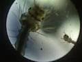 More Mosquito Larvae, Blackberry video through Microscope!