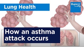How an asthma attack occurs