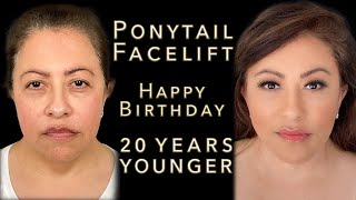 Ponytail Facelift For Her Birthday! Plastic Surgery Before And After - KaoEyes, Jowl Lift, Neck Lift