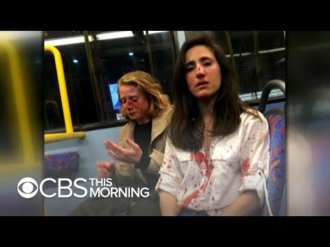 Victim of homophobic bus attack speaks out