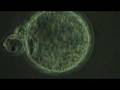 In Vitro Fertilization (IVF) for Chicago
