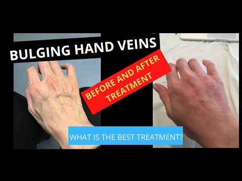 how to treat ugly hands