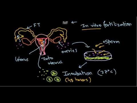how to fertilize woman's egg