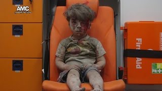 Image of Aleppo boy shocks world; Russia offers cease-fires