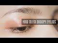 How To Fix A Droopy Eyebrow