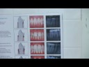 Teeth Whitening : Gingivitis Symptoms Teeth Whitening : Gingivitis Symptoms