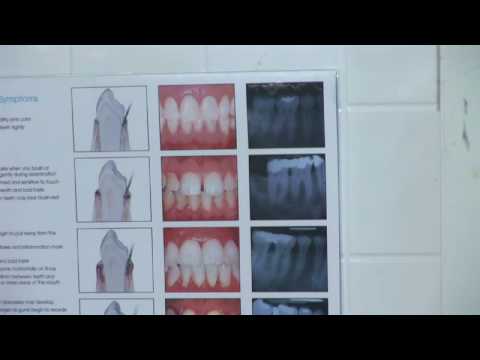 how to cure bad breath ehow