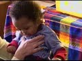 Preventing Shaken Baby Syndrome Edwards syndrome