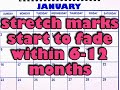 During pregnancy your belly will stretch - and so will your skin. If you want to prevent stretch marks or make them fade away post-partum, then watch this pregnancy video. Pregnancy.Healthguru.com