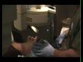 lasic eye surgury