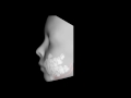 Orthodontics In 3D