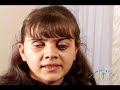 Миссионерская школа для незрячих