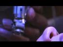Lasik Surgery Lasik Surgery