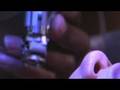 Lasik Surgery Lasik Surgery