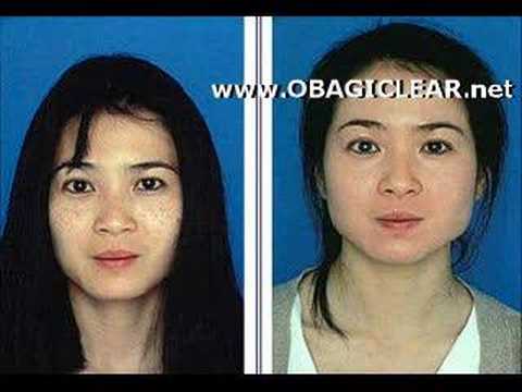 OBAGI Skin Care RESULTS