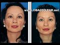 OBAGI Skin Care RESULTS OBAGI Skin Care RESULTS