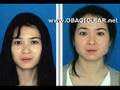 OBAGI Skin Care RESULTS
