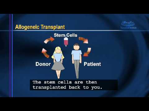 how to transplant stem cells