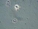 Infected cell