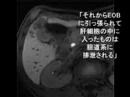 EOBプリモビストMRI のはじめ方、秘訣