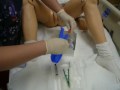 Female Catheter Insertion Female Catheter Insertion