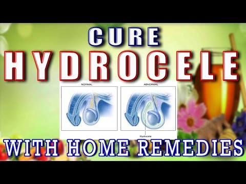 how to relieve hydrocele pain