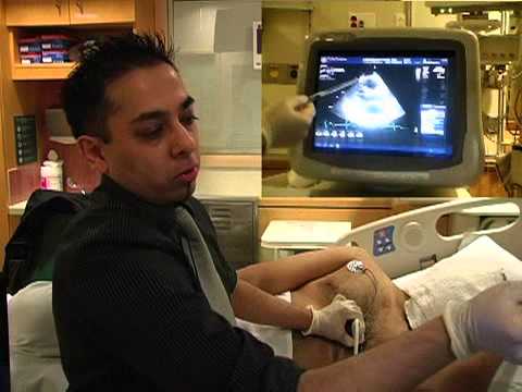 how to obtain ejection fraction