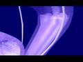 Urology: Not Just For Men! (Dramatic Health)