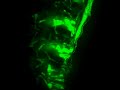 Olympus DSU Spinning Disk confocal
