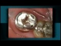 Dr Rosenberg and His Before and After Cosmetic Dental Photos