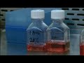 Regenocyte Stem Cell Therapy for Heart Disease - Part 1 of 4