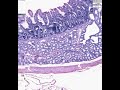 Shotgun Histology Gastro-Duodenal Junction Shotgun Histology Gastro-Duodenal Junction