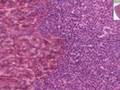 Histología - Glándula suprarrenal