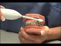Fry Orthodontic Specialists: Brushing with Braces