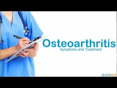 how to treat osteoarthritis