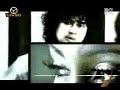 gigi-nakal